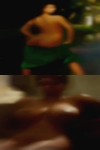 Girls with stretchmarks